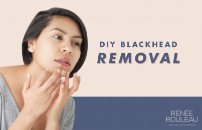 remove blackheads from face