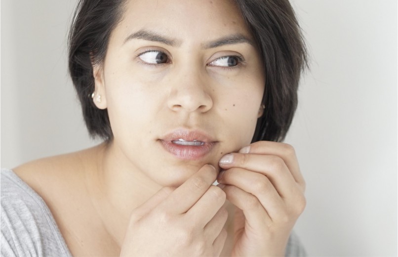 How to Break a Skin Picking Habit