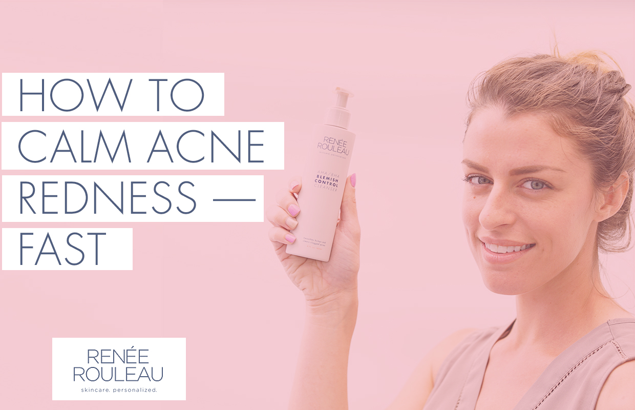 Reduce From Acne Five Skincare Ingredients