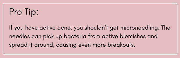 Pro tip about not getting microneedling with active acne because it can lead to more blemishes