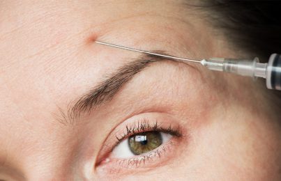Woman with Botox syringe near her forehead