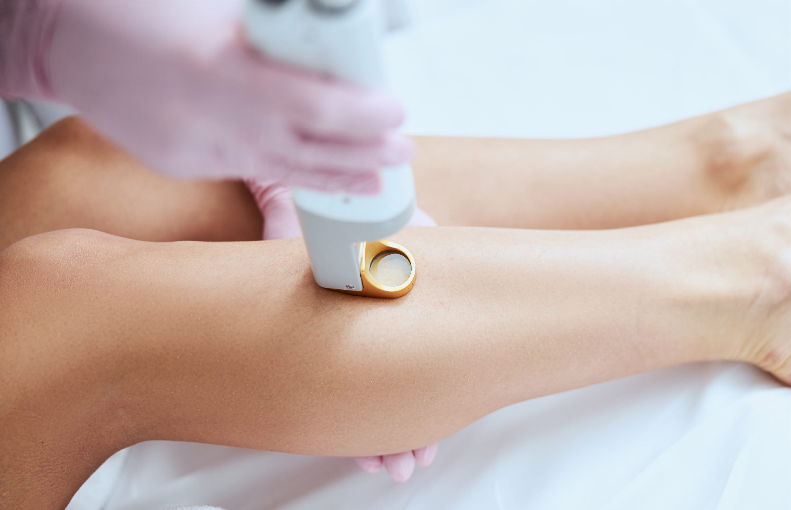 Should You Get Laser Hair Removal Estheticians Weigh In 