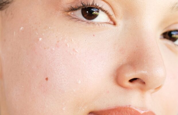 sunscreen can be seen peeling from the skin.