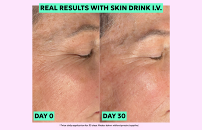 Skin Drink I.V. Blog