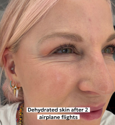 I Tested My Skin's Limits on a Desert Trip. Here's the Fix That Saved It