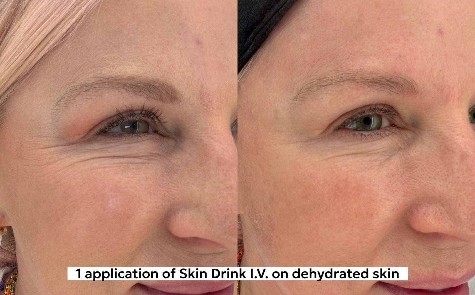 before and after using hydrating serum on dehydrated skin